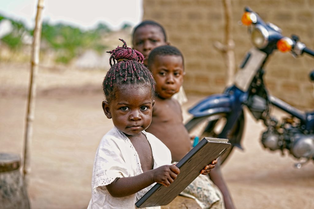 Three Nigerian children show signs of malnutrition